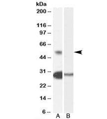 Western blot testing of human testis lysate with TCFL5 antibody at 0.3ug/ml with [B] and without [A] blocking/immunizing peptide. Predicted molecular weight: ~53kDa.