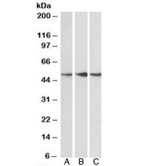Western blot testing of human cerebellum [A], mouse [B] and rat [C] brain lysate with PPP2R5E antibody at 0.1ug/ml. Predicted molecular weight: 50~56kDa.