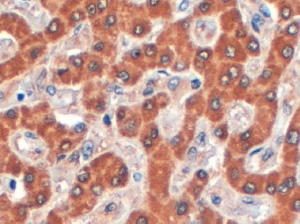 IHC testing of FFPE human liver with Syntenin 2 antibody at 4ug/ml. HIER: steamed with pH6 citrate buffer, HRP-staining.