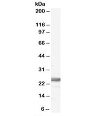 Western blot testing of human testis lysate with Ribosomal Protein L19 antibody at 0.1ug/ml. Expected molecular weight: 23-28 kDa.