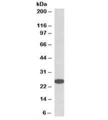 Western blot testing of HeLa lysate with RanBP1 antibody at 0.05ug/ml. Expected molecular weight: 23-26 kDa.