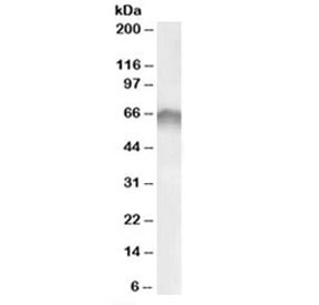Western blot testing of human colon lysate with CRF1 antibody at 0.1ug/ml. Predicted molecular weight: ~48/60-70 kDa (unmodified/glycosylated).
