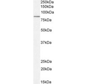 Western blot testing of human lung lysate with TG2 antibody at 0.03ug/ml. Predicted molecular weight: ~78kDa, observed here at ~90kDa.