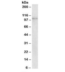 Western blot testing of human breast cancer lysate with NLRX1 antibody at 2ug/ml. Predicted molecular weight: ~108/102kDa (isoforms 1/2).