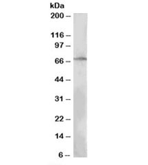 Western blot testing of MOLT4 lysate with LNK antibody at 0.3ug/ml. Predicted molecular weight: ~63 kDa.