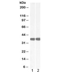 Western blot testing of 1) mouse liver and 2) rat liver lysate with Arginase antibody at 0.05ug/ml. Predicted molecular weight ~35kDa.