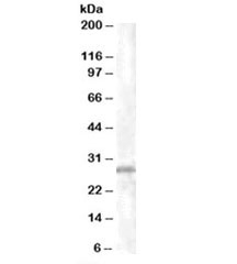 Western blot testing of K562 lysate with CHMP5 antibody at 1ug/ml. Predicted molecular weight: ~25kDa.