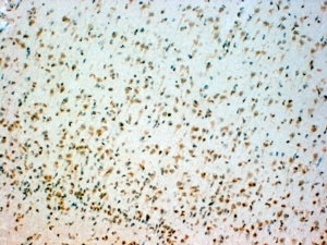 IHC testing of FFPE human brain stem with TPH2 antibody at 4ug/ml. HIER: steamed with pH6 citrate buffer, HRP-staining.