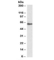Western blot testing of human kidney lysate with GGT1 antibody at 0.1ug/ml. Predicted molecular weight ~61kDa.