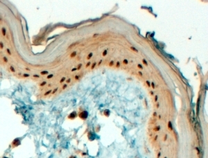 IHC testing of FFPE human skin with TFAP2C antibody at 4ug/ml. HIER: steamed with pH9 Tris/EDTA buffer, HRP-staining.