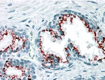 IHC staining of FFPE human prostate with GOLPH2 antibody at 3.75ug/ml. HIER: steamed with pH6 citrate buffer, AP-staining.