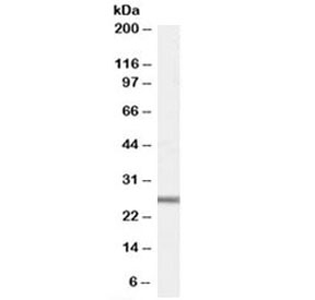 Western blot testing of mouse heart lysate with GPX3 antibody at 1ug/ml. Expected molecular weight: 23-26 kDa.