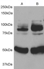 Western blot testing of rat aortic smooth muscle cells before (1) and after (2) infection with human APPL1 adenovirus for 48hrs. APPL1 antibody was used at 0.5ug/ml. The expected ~80kDa response is significantly stronger in the infected sample.