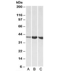 Western blot testing of A) human, B) mouse and C) rat skeletal muscle lysates with Aldolase A antibody at 1ug/ml. Predicted molecular weight: ~40kDa.