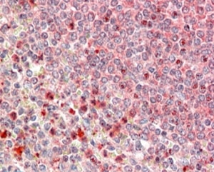 IHC testing of FFPE human spleen with UBR4 antibody at 5ug/ml. HIER: steamed with pH6 citrate buffer, AP-staining.