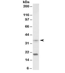 Western blot testing of mouse spleen lysate with HOXA9 antibody at 2ug/ml. Predicted molecular weight ~30kDa, both bands are blocked by the immunizing peptide.