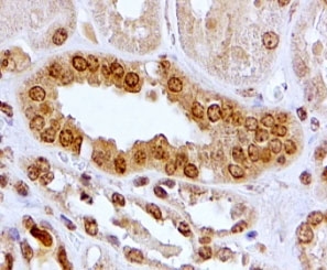 IHC testing of FFPE human kidney with Aryl Hydrocarbon Receptor antibody at 2ug/ml. HIER: steamed with pH6 citrate buffer, HRP-staining.