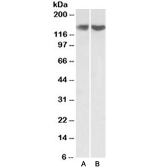 Western blot testing of HEK293 [A] and HeLa [B] lysate with REST antibody at 0.3ug/ml. Predicted molecular weight ~122kDa but routinely observed at ~140kDa.