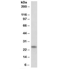 Western blot testing of human skeletal muscle lysate with TNNI1 antibody at 0.03ug/ml. Predicted molecular weight: ~22kDa.