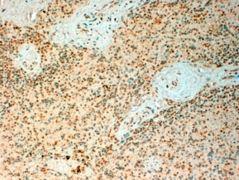 IHC testing of FFPE human spleen with TET2 antibody at 4ug/ml. HIER: steamed with pH6 citrate buffer, HRP-staining.