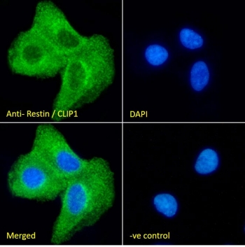 Immunofluorescent staining of fixed and permeabilized human A549 cells with CLIP antibody (green) at 10ug/ml and DAPI nuclear stain (blue).