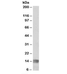 Western blot testing of human glioma lysate with MIA antibody at 1ug/ml. Predicted molecular weight: ~14kDa.