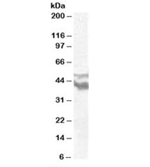 Western blot testing of  human brain frontal cortex lysate with DYX1C1 antibody at 0.5ug/ml. Predicted molecular weight: ~48/44/44kDa (isoforms a/b/c).