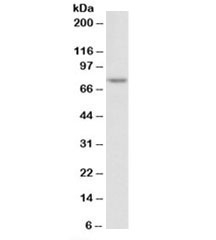 Western blot testing of Jurkat nuclear lysate with TDP1 antibody at 2ug/ml. Predicted molecular weight: ~68kDa.