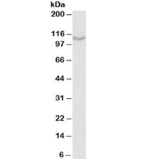 Western blot testing of U937 lysate with CD68 antibody at 1ug/ml. Predicted molecular weight 37~110 kDa depending on glycosylation level.