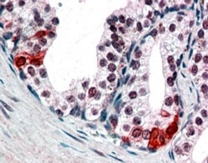 IHC testing of FFPE human prostate shows nuclear staining in secretory epithelial cells. SMARCE1 antibody was used at 3ug/ml.