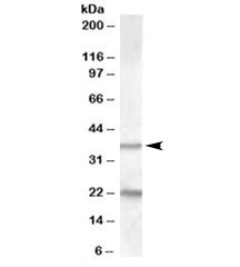 Western blot testing of human liver lysate with TUSC3 antibody at 1ug/ml. The expected ~37kDa band and the additional ~22kDa band are blocked by the immunizing peptide.