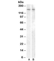 Western blot testing of human amygdala lysate with AVPR1B antibody, cat # R35132 (0.5ug/ml, lane A) and rat brain lysate with AVPR1B antibody, cat # R34558 (0.05ug/ml, lane B). Predicted molecular weight: ~47/170kDa (unmodified/modified).