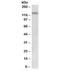 Western blot testing of human uterus lysate with KDM2A antibody at 0.5ug/ml. Predicted molecular weight: ~133kDa.