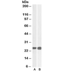 Western blot  of human thymus (A) and MOLT4 (B) lysates with GRB2 antibody at 0.05ug/ml. Predicted molecular weight ~25kDa.