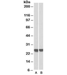 Western blot  of MOLT4 (A) and human thymus (B) lysates with GRB2 antibody at 0.3ug/ml. Predicted molecular weight ~25kDa. An NAP blocker was used in place of non-fat milk as blocking solution and diluent. (1)