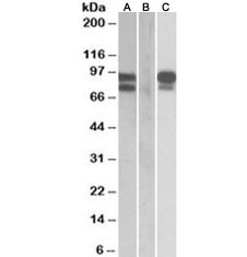 Western blot of HEK293 lysate overexpressing human PCSK9 with MYC tag probed with PCSK9 antibody (0.5ug/ml) in Lane A and probed with anti-MYC tag (1/1000) in lane C. Mock-transfected HEK293 probed with PCSK9 antibody (1ug/ml) in Lane B.