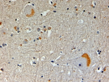 IHC testing of FFPE human brain with NOS1AP antibody at 4ug/ml. HIER: steamed with pH9 Tris/EDTA buffer, HRP-staining.