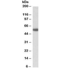 Western blot testing of human prostate lysate with ADRA1A antibody at 1ug/ml. Predicted molecular weight: ~52kDa.