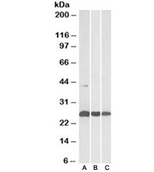 Western blot testing of human [A], mouse [B] and rat [C] heart lysates with DUSP6 antibody at 0.3ug/ml. Predicted molecular weight ~42/26kDa (isoforms a/b).