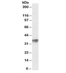Western blot testing of human testis lysate with FBXO4 antibody at 0.5ug/ml. Predicted molecular weight: ~35kDa.