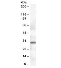 Western blot testing of human lymph node lysate with Syntaxin 6 antibody at 0.3ug/ml. Predicted molecular weight: ~29kDa.