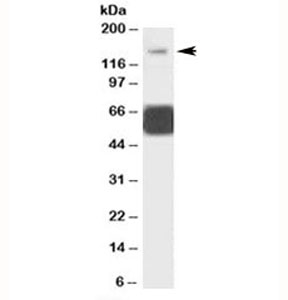 Western blot testing of human cerebellum lysate with GRIK1 antibody at 1ug/ml. Predicted molecular weight: ~104/150+ kDa (unmodified/glycosylated). Both observed bands are blocked by the addition of immunzing peptide.