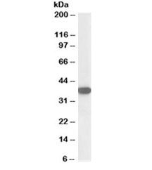 Western blot testing of Jurkat lysate with Nucleophosmin antibody at 0.1ug/ml. Expected/observed molecular weight: ~38kDa.