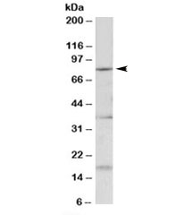 Western blot testing of mouse fetal brain lysate with Kcnc3 antibody at 0.2ug/ml. Predicted molecular weight: ~80kDa.