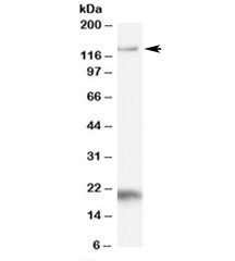 Western blot testing of Daudi cell lysate with HTATSF1 antibody at 1ug/ml. Rountinely observed at 130-140kDa. Both bands are blocked by immunizing peptide.