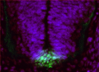 IHC testing of a PFA-perfused cryosection of mouse embryo E13.5 with Ferd3l antibody at 1ug/ml (Alexa Fluor 488 detection, green).  Nuclear counterstain with DAPI (blue).