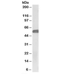 Western blot testing of human hippocampus lysate with GLP1R antibody at 1ug/ml. Predicted molecular weight ~53 kDa.