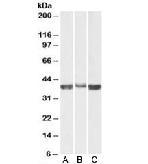 Western blot testing of A) human, B) mouse and C) rat skeletal muscle lysates with Aldolase A antibody at 0.03ug/ml. Predicted molecular weight: ~40kDa.