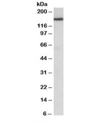 Western blot testing of rat brain lysate with Zcchc11 antibody at 0.05ug/ml. Predicted/observed molecular weight (rat): ~163kDa.
