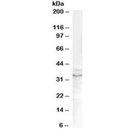 Western blot testing of human prostate lysate with GDF15 antibody at 0.1ug/ml. Predicted molecular weight ~34 kDa (pro-form) and ~25 kDa (mature form).